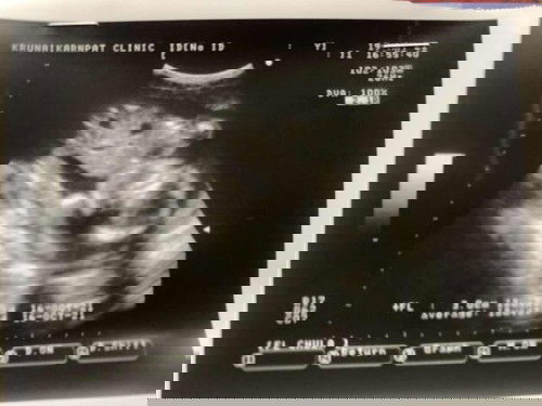 ถามแม่ๆค่ะ ช่วยดูทีค่ะว่า ญ หรือ ช