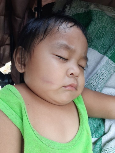 Nawawalan ng hininga si baby