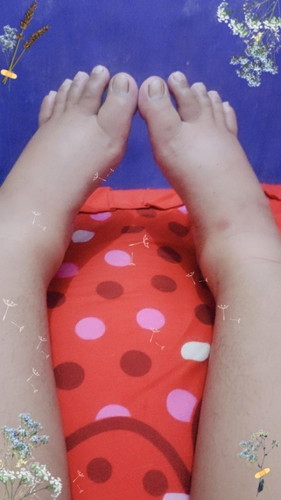 Bunda ada yang ngalamin kaki bengkak saat usia kandung 33week tidak?? Gmna biar cpt kempes yah??