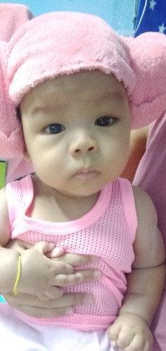เด็กตาขี้เกียจ