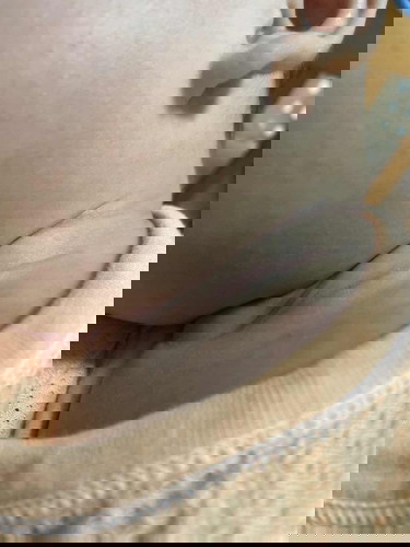 Concern about bb’s neck