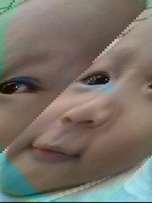 bercak putih di deket mata