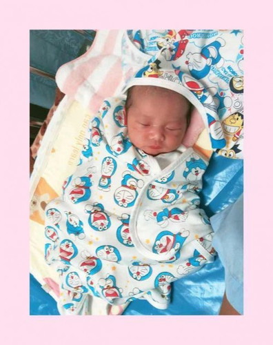 #ผ่าคลอดท้องแรก