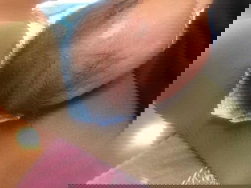 ทำยังไงๆขที่หัวน้องจะหมดไป