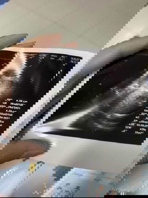 ลูกชายของแม่🥰