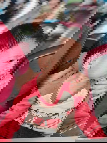 อีสุกอีใส ในวัน 1 ขวบ 5 เดือน