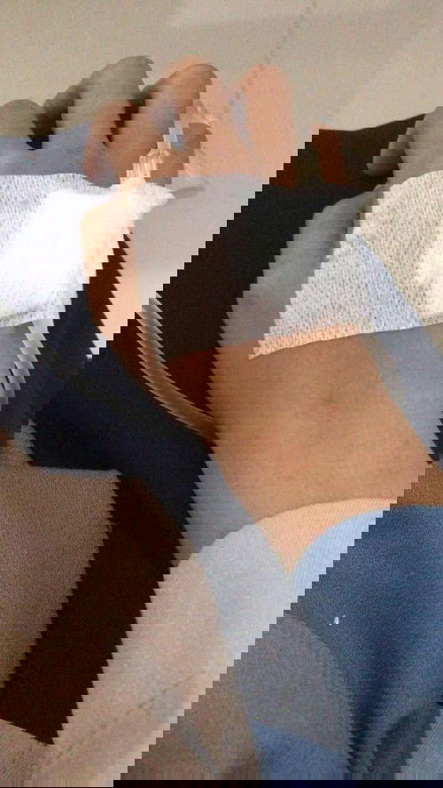 Dehidrasi dan mual muntah