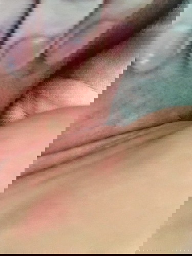 Bé nhà em cổ bị nổi nốt sần lên như này là bị sao thế ạ