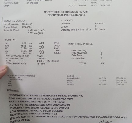 Anopoba susundin na due date po sa taas poba o baba