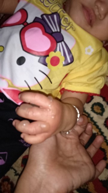 Bayi 1 tahun