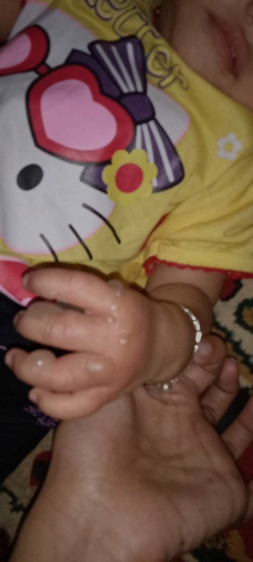 1 tahun bayi perempuan