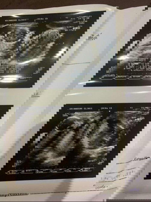 ลูกดิ้นบ่อยและนานเป็นอะไรมั้ย