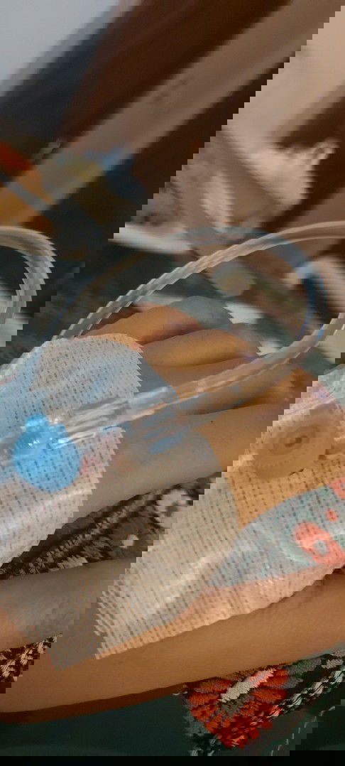 Pengalaman plasenta previa total