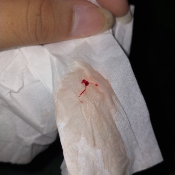 มีเลือดออกจากช่องคลอด