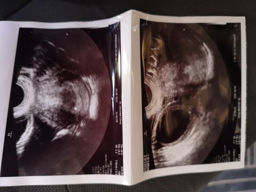 อยากสอบถามแม่ๆหน่อยค่ะ