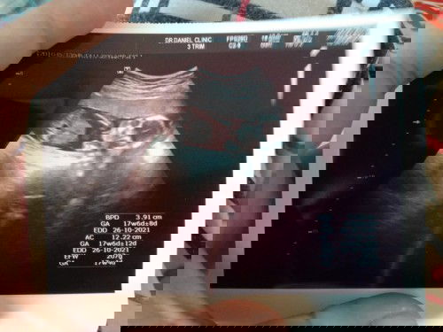 ทีมตุลาคม​