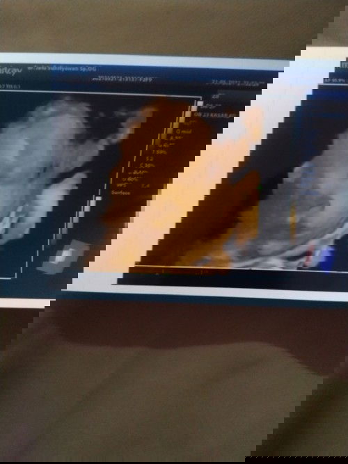 cara naikin berat badan janin