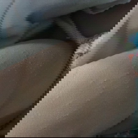 ผื่นขึ้นแบบนี้ทำไงดีค้ะ