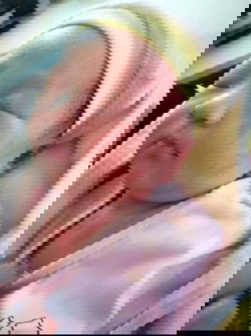 Rôm sấy, hăm , nổi mẩn xót