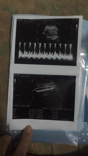 ตอนนี้ตั้งท้องได้9เดือนแล้วหมอบอกว่าน้องมีน้ำหนัก1909น้อบตัวเล็กแม่ๆท่านไหนมีอะไรแนะนำมาบำรุงได้บ้างคะ กำหนด21มิถุนายน