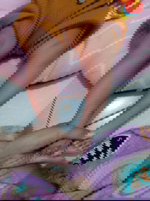 Kaki bayi agak bengkok