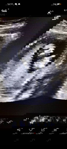 13สัปดาห์3วัน