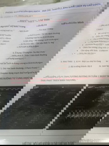 Chỉ sô có thấp quá không các món