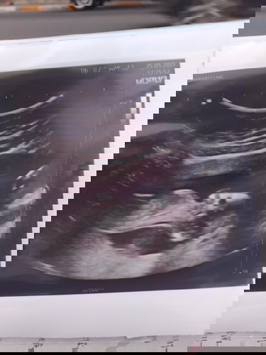 13w+3 เห็นเพศกันรึยังคะ