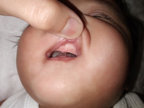 Teething Baby