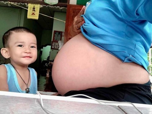 อยากจะชวนเม้ามอยแชร์อาการของคุณแม่ท้องสองกันค่ะ