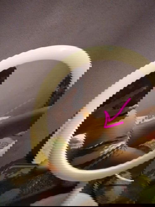 ไม่รู้ไขมันแม่หรือเป็นตัวน้องแล้ว