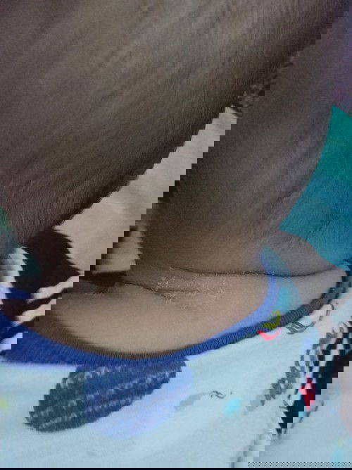 Rashes to change skin