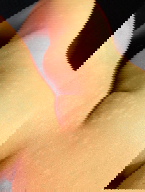 Bintik2 putih di badan