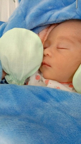 ผ่าคลอดบล็อกหลัง+ครรภ์เป็นพิษคะ