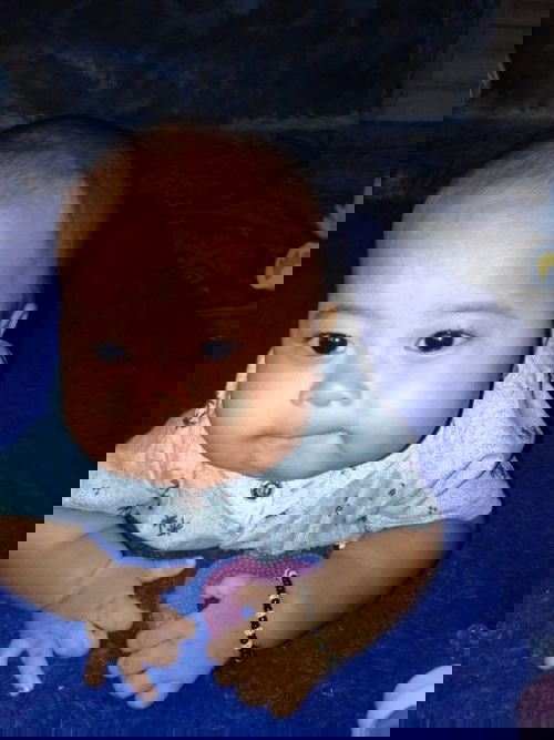 7 bulan belum bisa duduk mandiri