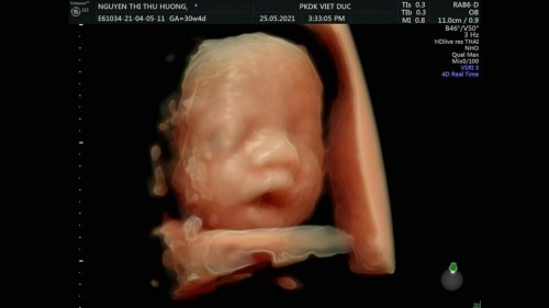 xin í kiến