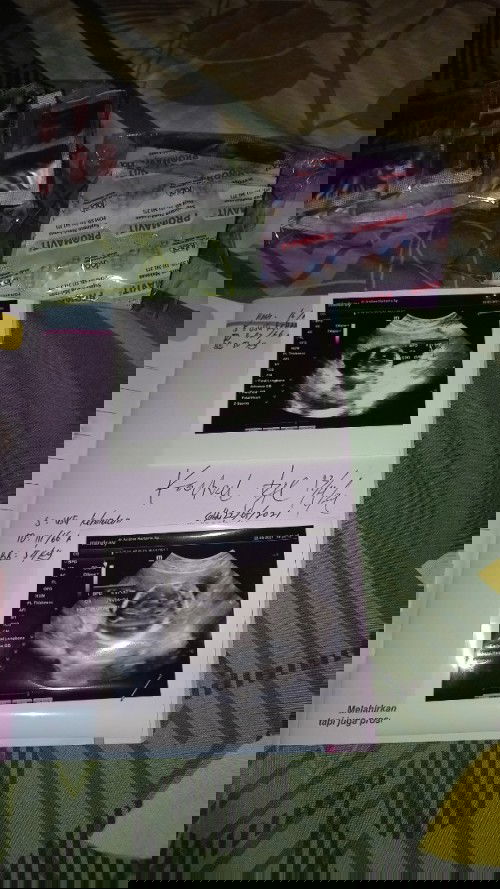 Baru USG kedua kali puji syukur semua keadaan  baik , semoga persalinan nanti di lancarkan semua🙏