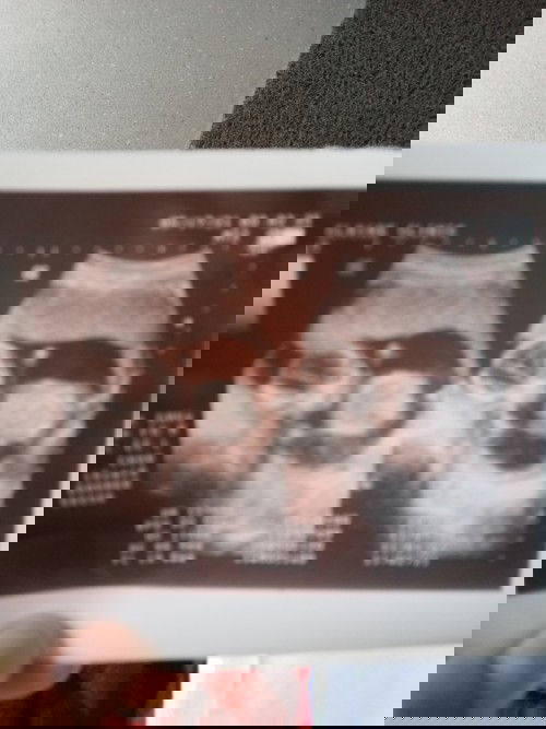 C-section ako at kinakabahan ako pakiramdam ko hindi ko kaya!  😪