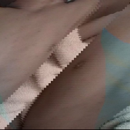 ผื่นไรค่ะ?