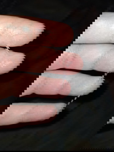 มีมูกใส 39w3d