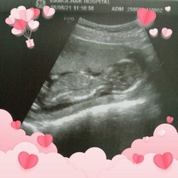 ท้องแรกดูไม่เป็นช่วยดูหน่อยคะ😂😂