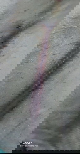 CS scar - bubuka ba?