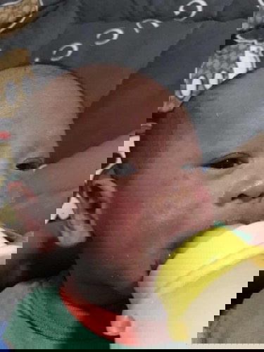 ผดแบบนี้ใช่อะไรถึงหายคะแม่ๆ