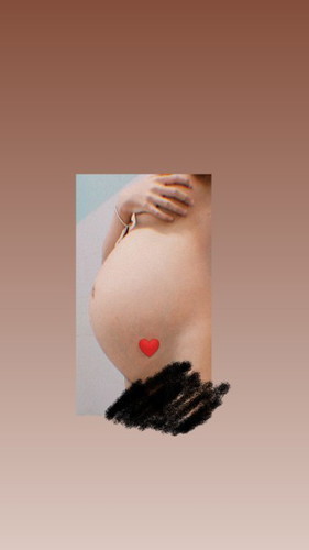 ท้องเเรก33+1สัปดาห์