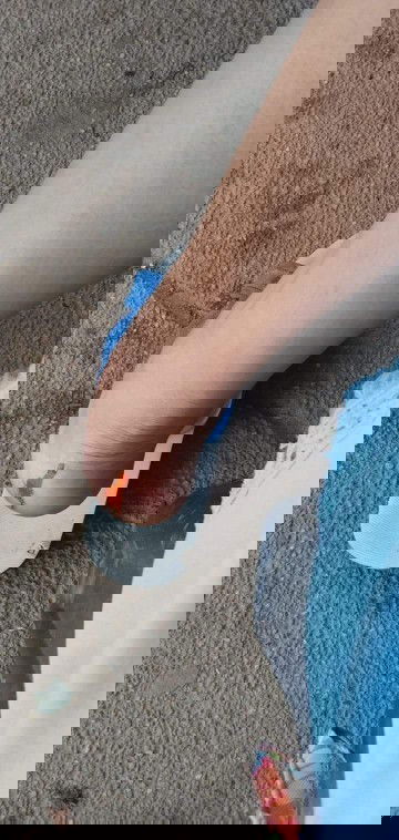 สะดุดล้มต้องไปหาหมอไหมคะ