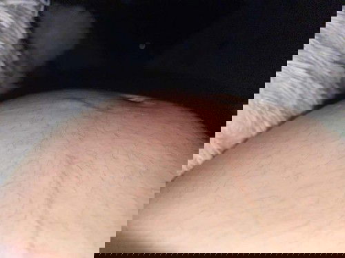 ท้อง9เดือน มีตุ่มแบบนี้ไหญ่ๆขึ้นตามท้อง