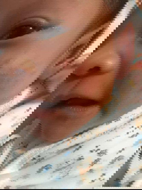 ขออนุญาตถามแม่ๆหน่อยค่ะ น้องขึ้นผื่นแบบนี้ใช้ไรถึงจะหายหรือมีวิธีอะไรจะแนะนำไหมค่ะ แม่มือใหม่ค่ะ