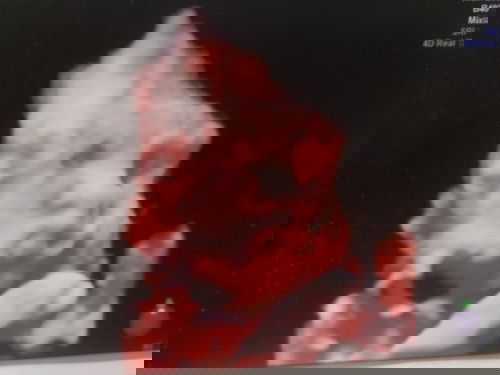 Picture ni Baby 🥰