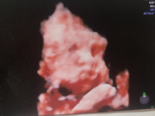 Picture ni Baby π₯°