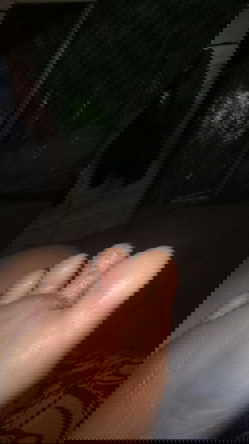 Cari obat kutu air / eksin